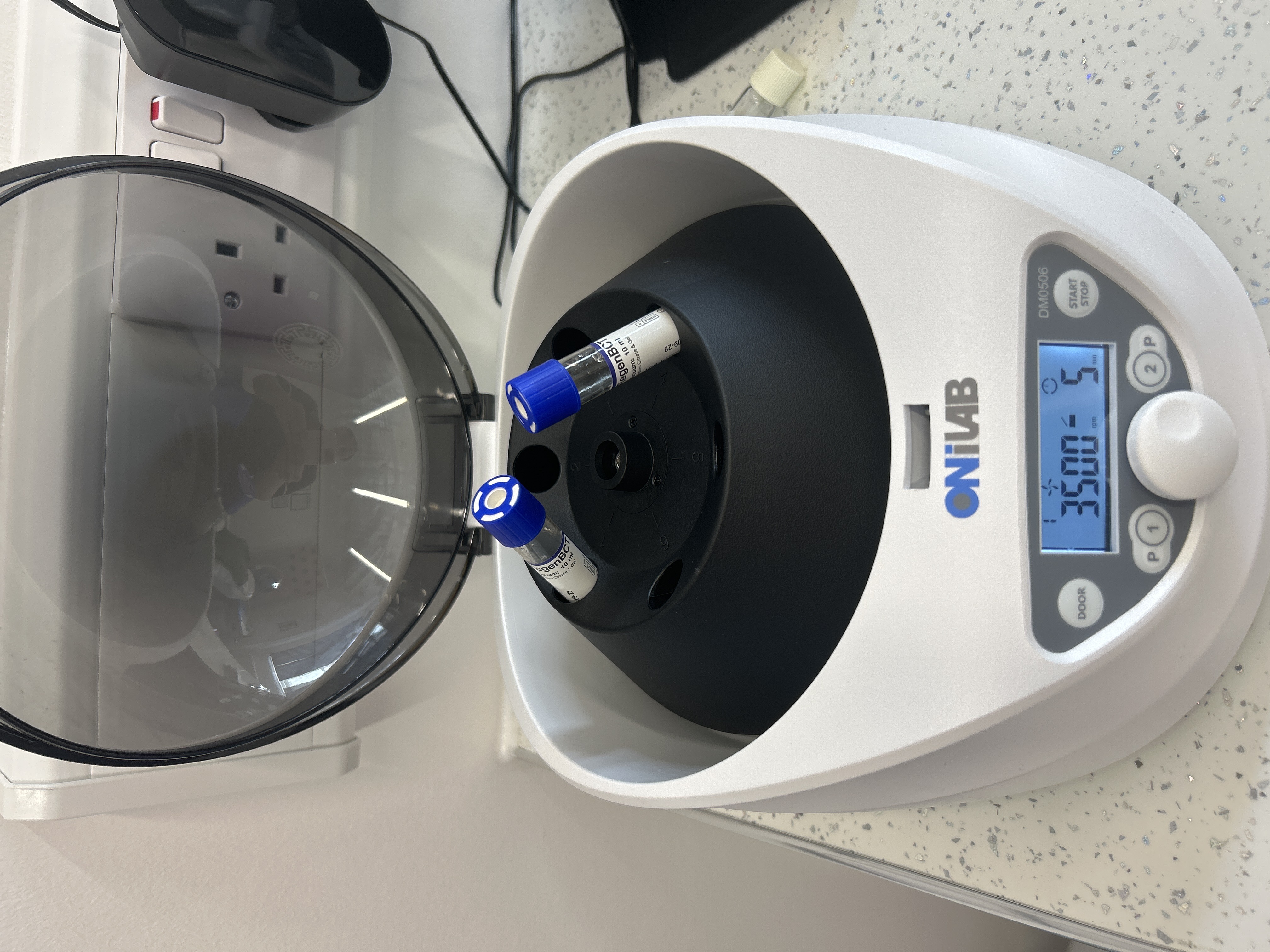 PRP treatment in progress